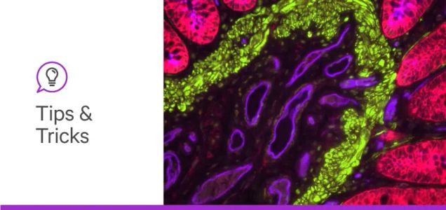 5 ways lectins contribute to glycobiology
