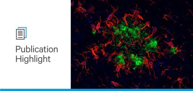 Alzheimer’s Awareness Month: The Impact of IL-17 Accumulation on Cognitive Deficit
