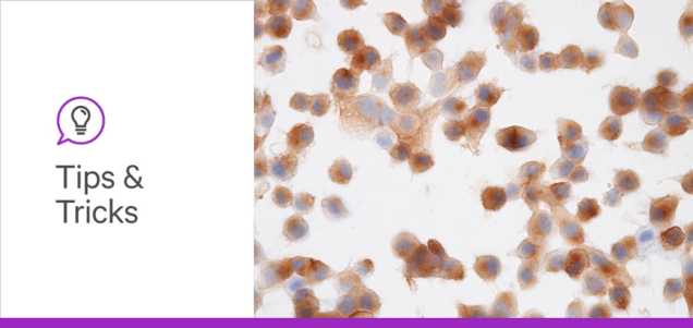 Glycans and Immune Checkpoints: Revealing Hidden Influences on Cancer Immunotherapy