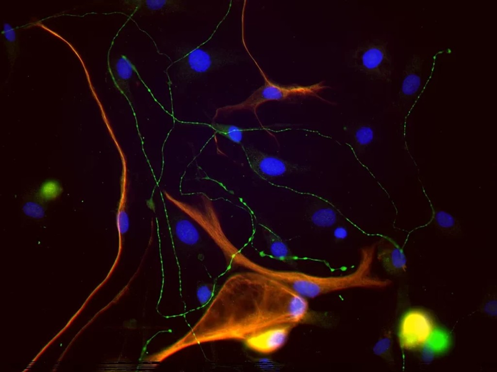 secondary antibodies pic3 768x575 1