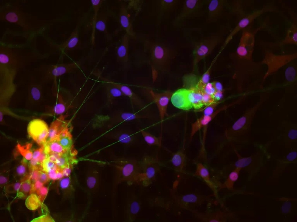 secondary antibodies pic2 768x575 1