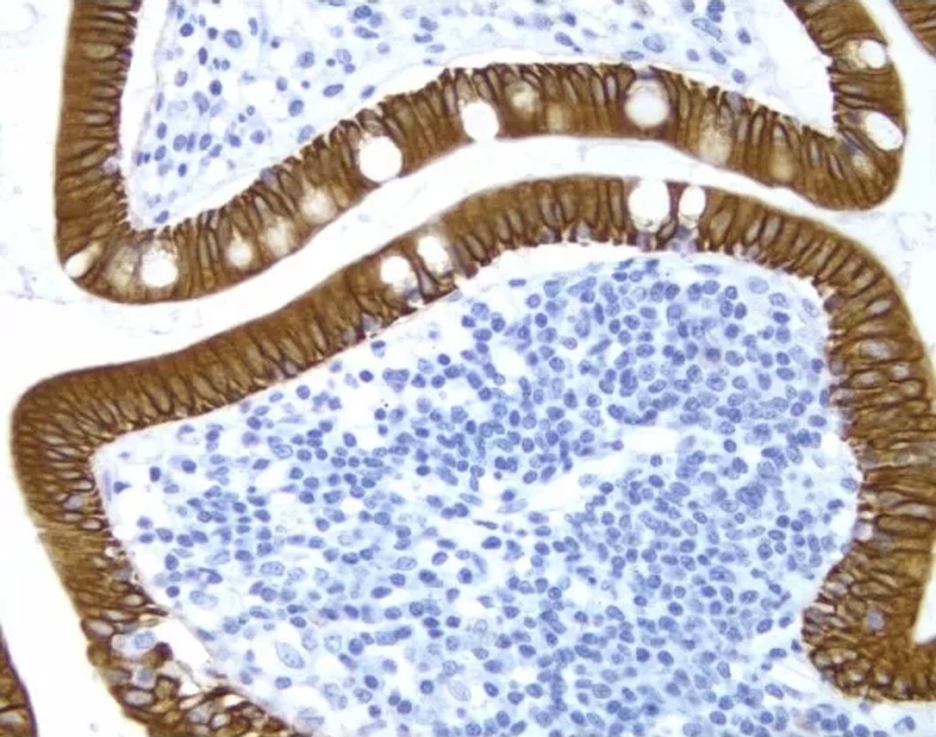 secondary antibodies pic1a