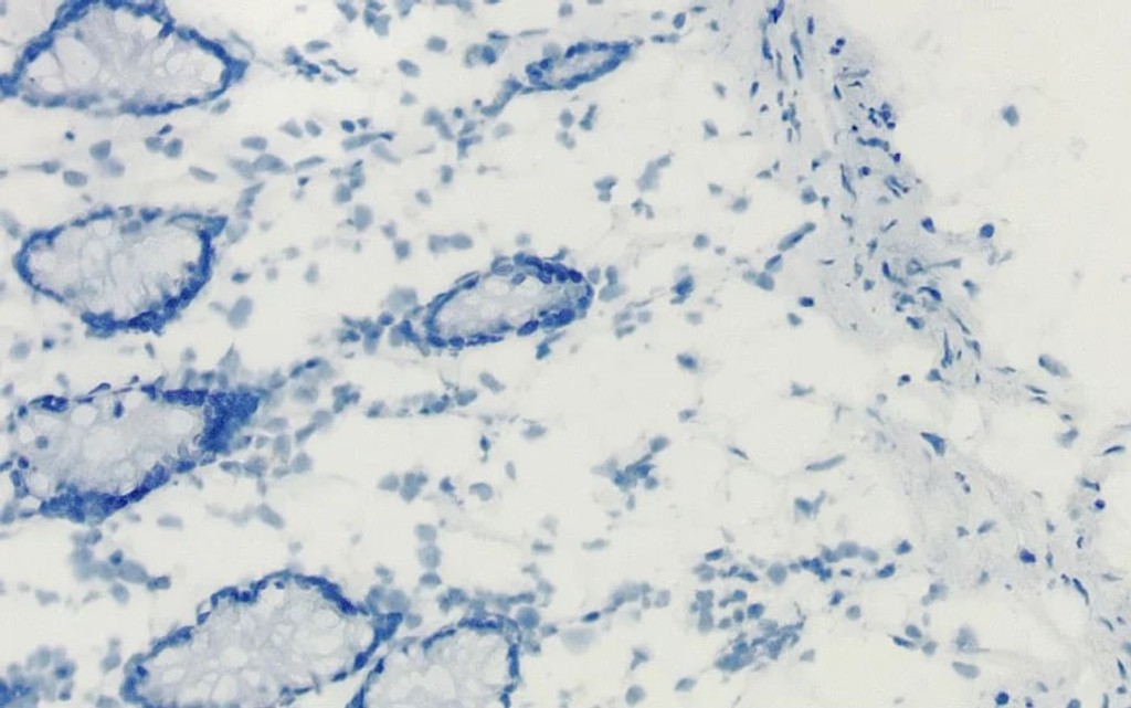 BR endogenous enzyme pic2 768x481 1