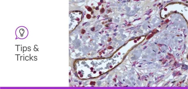 Honing Your Multiplex Immunohistochemistry Skills