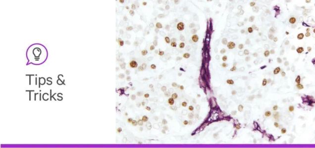 Top Considerations for Selecting Immunohistochemistry (IHC) Detection Reagents