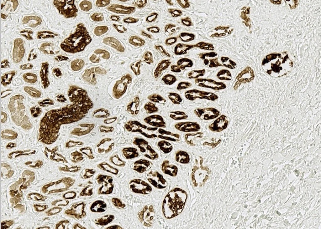 sos hoh kidney pic2 1024x732 1