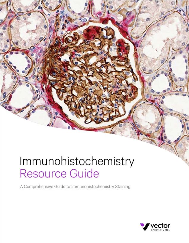 Immunohistochemistry Resource Guide
