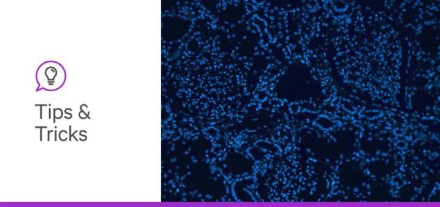 My staining didn’t work, part 3: IHC and IF staining tips