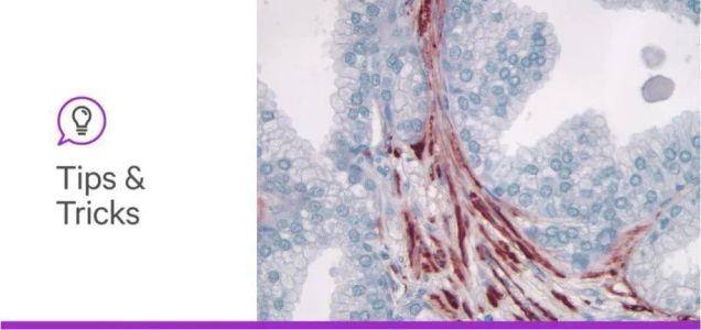 Improving IHC & IF Staining Results
