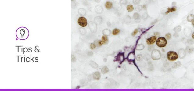 One-step, two-step, amplify: How to choose the right IHC detection system