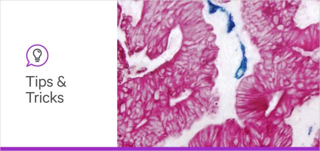 All about VECTASTAIN® ABC Kits for immunodetection