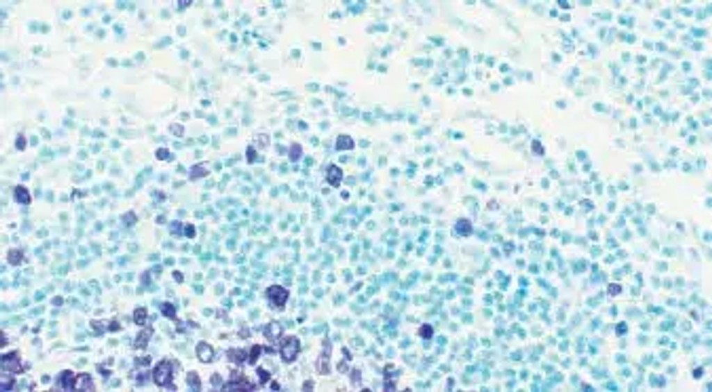Tonsil Counterstain Green