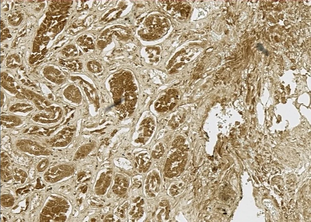 sos hoh kidney pic1 1024x732 1