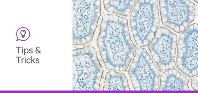 Simplifying Tissue Cross-Reactivity: Screening Humanized Antibodies in Human Tissue