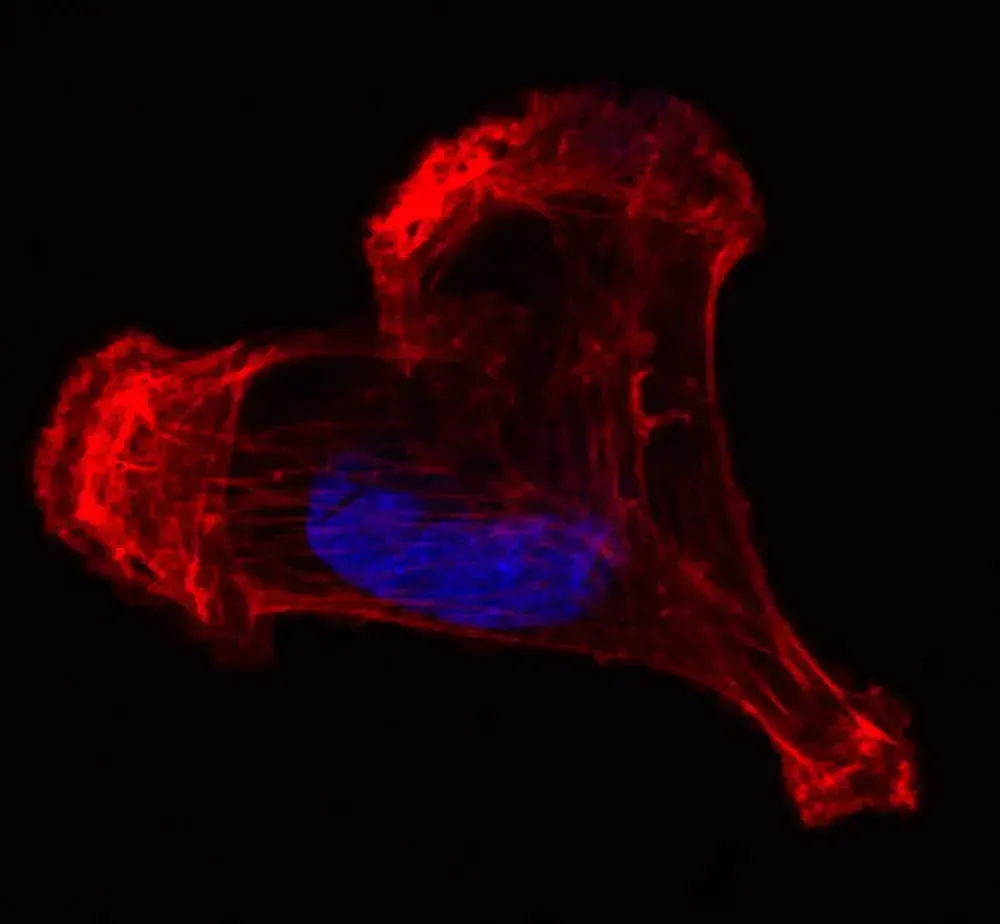RosaFontana MDA cytoskeleton RF 2 RosaFontana MDA cytoskeleton RF 2