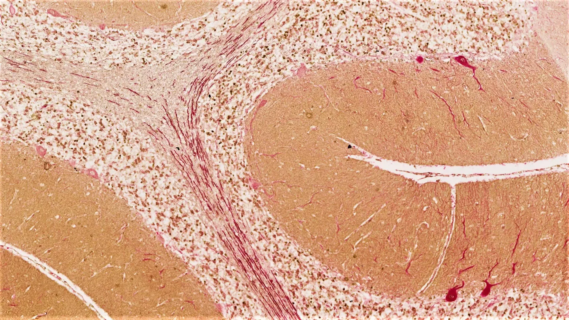 v mulligan human cerebellum v mulligan human cerebellum