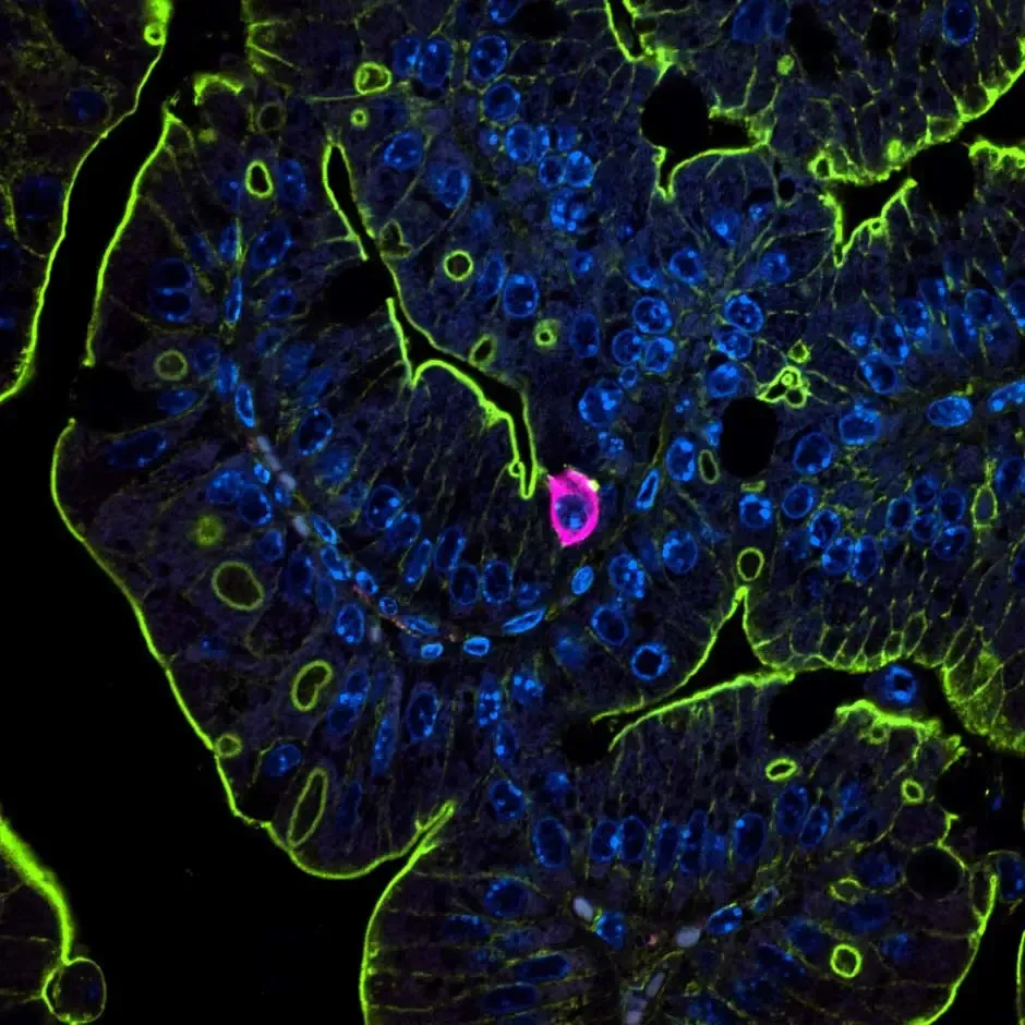 IzumiKaji Tuft cell M5BKO neo 1 IzumiKaji Tuft cell M5BKO neo 1