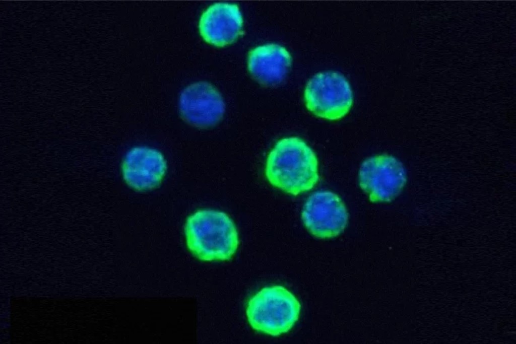 cancer recombinant anti CD20 768x512 1