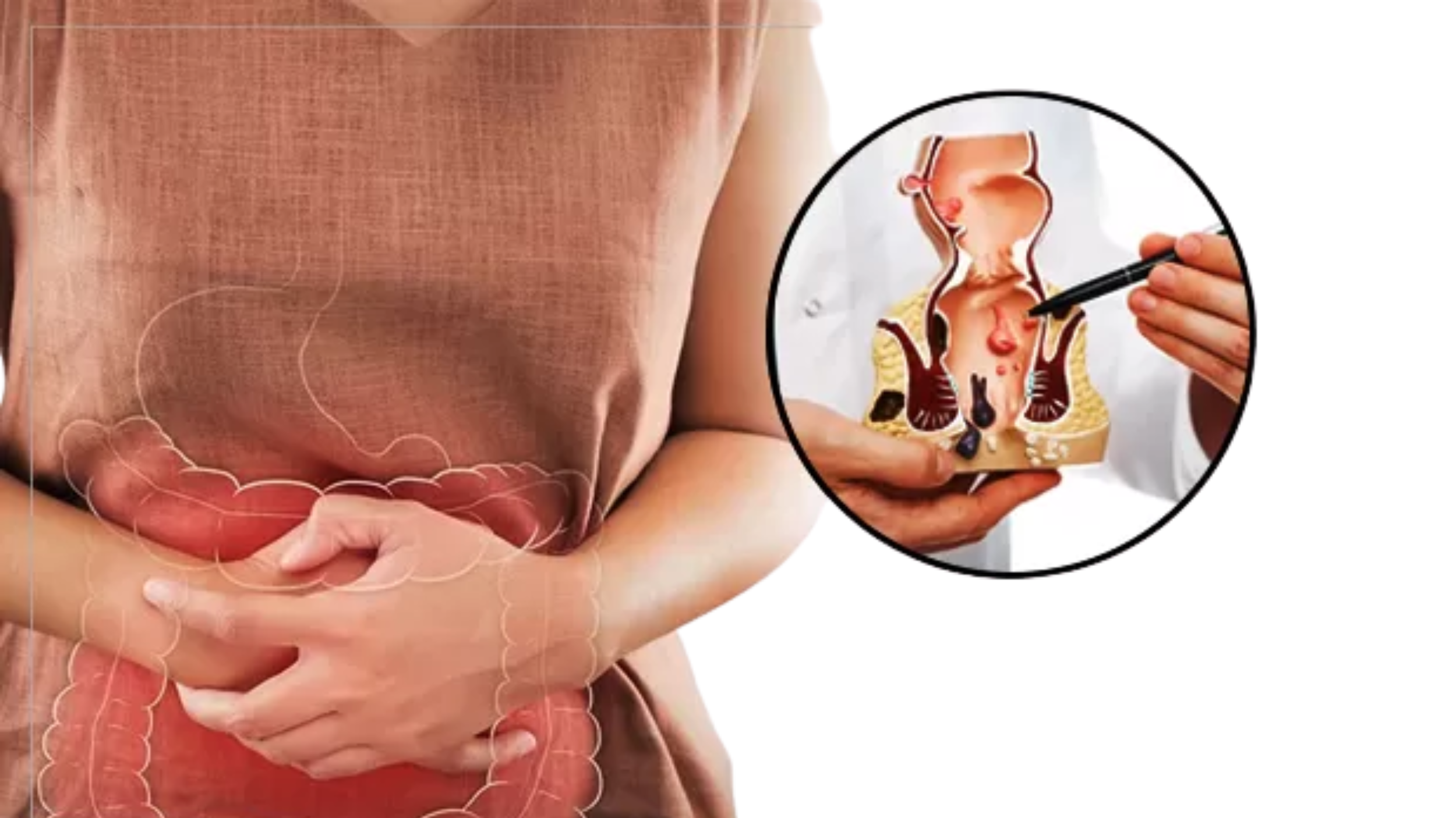 Constipation to Piles & Fissures