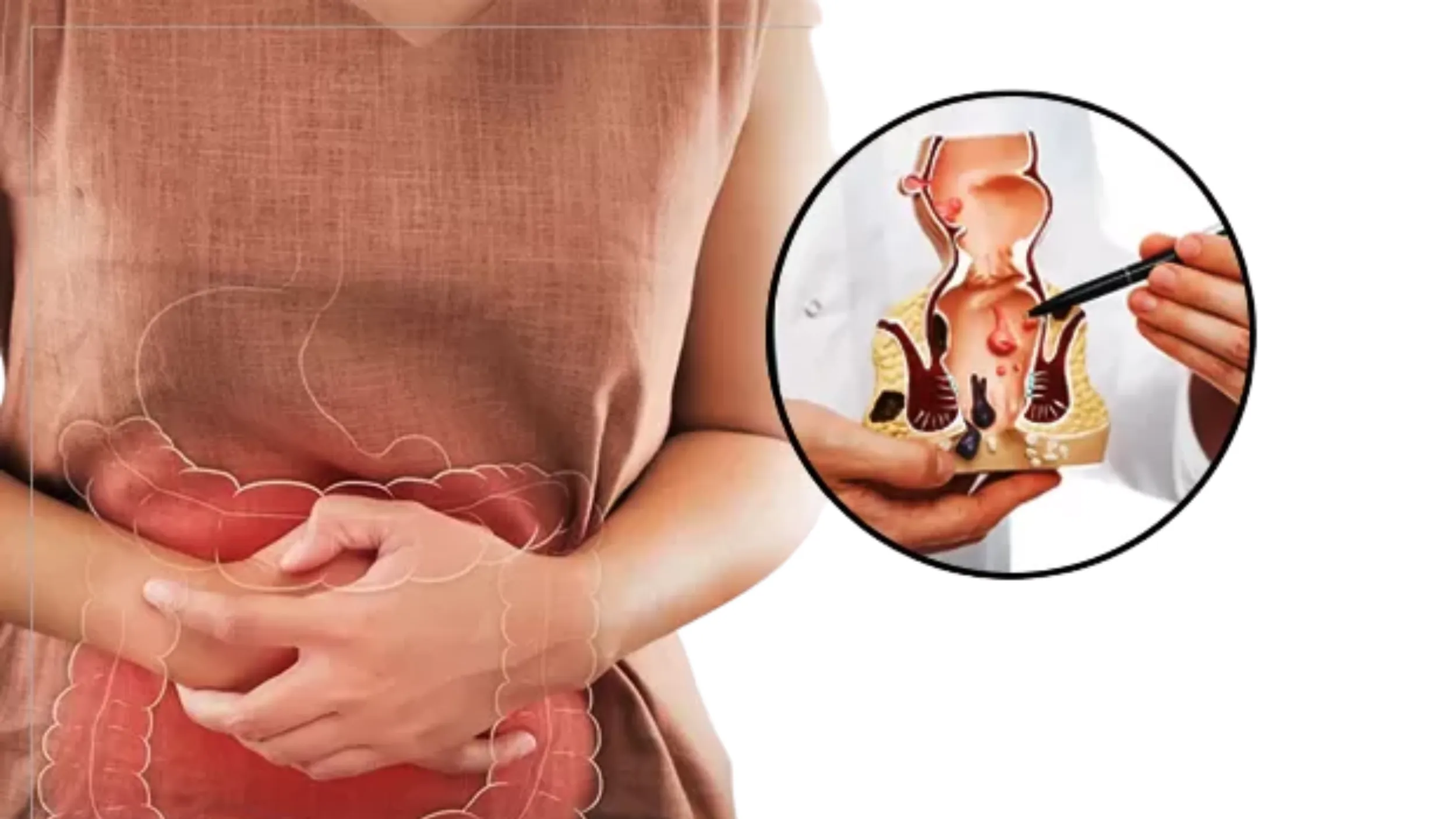 Constipation to Piles & Fissures