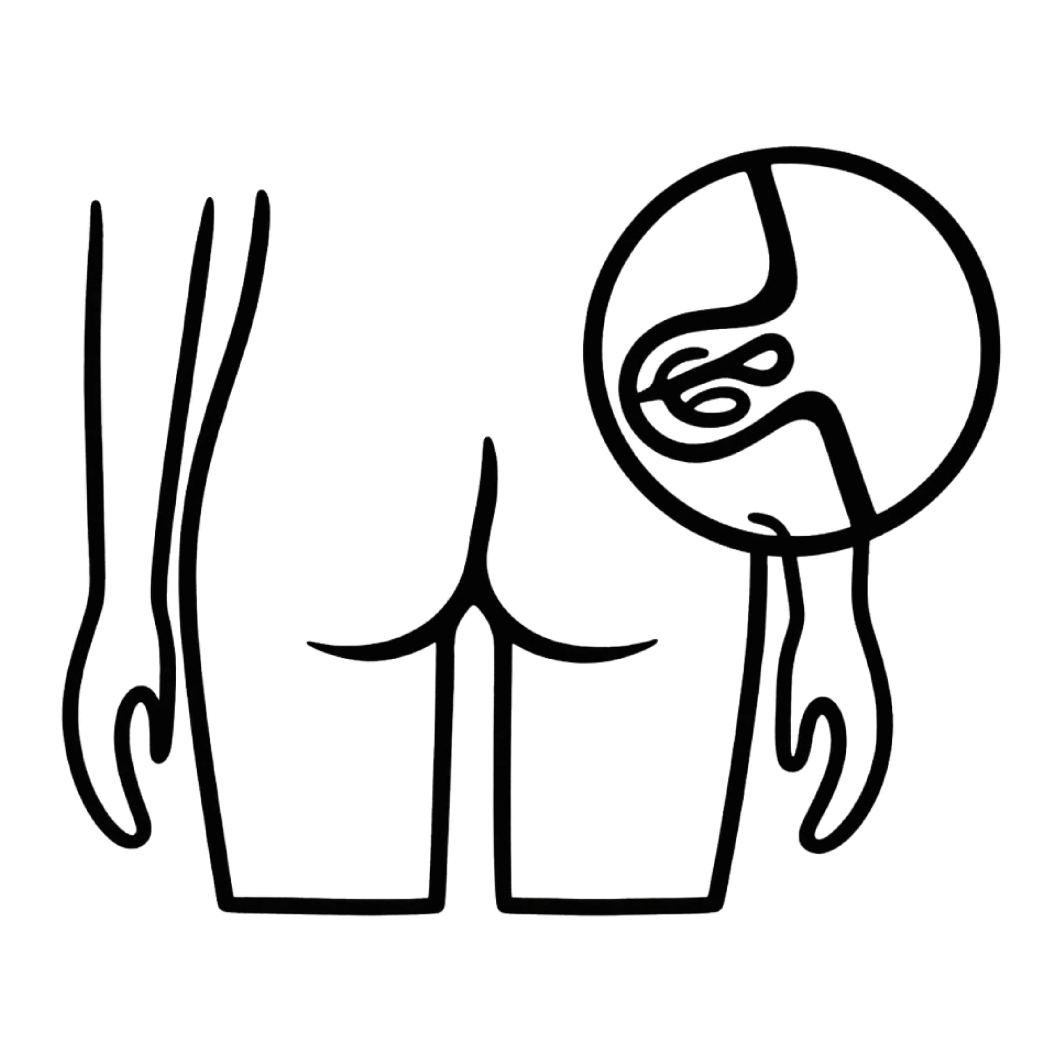 Pilonidal Sinus