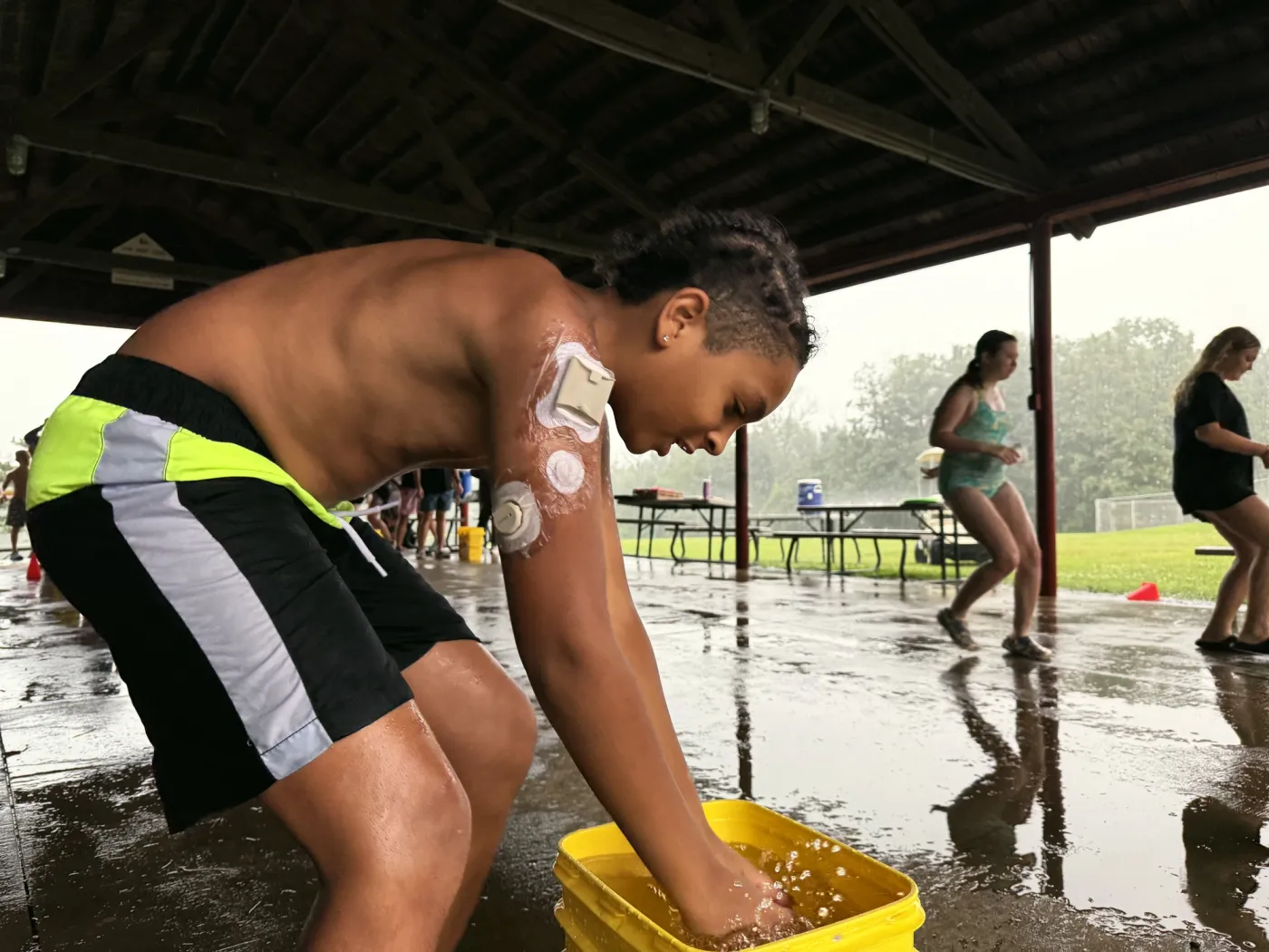 A young camper with a glucose sensor on his arm washes his hands under a covered pavilion