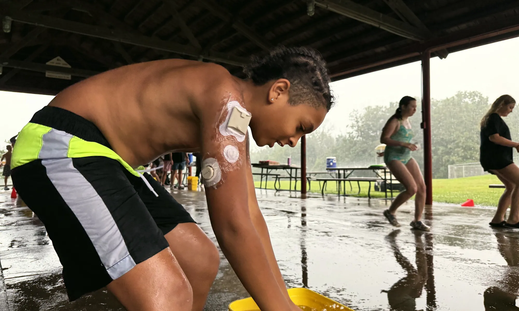 A camper with diabetes devices on his arm washes his hands in a bucket under the camp pavilion on a rainy day.