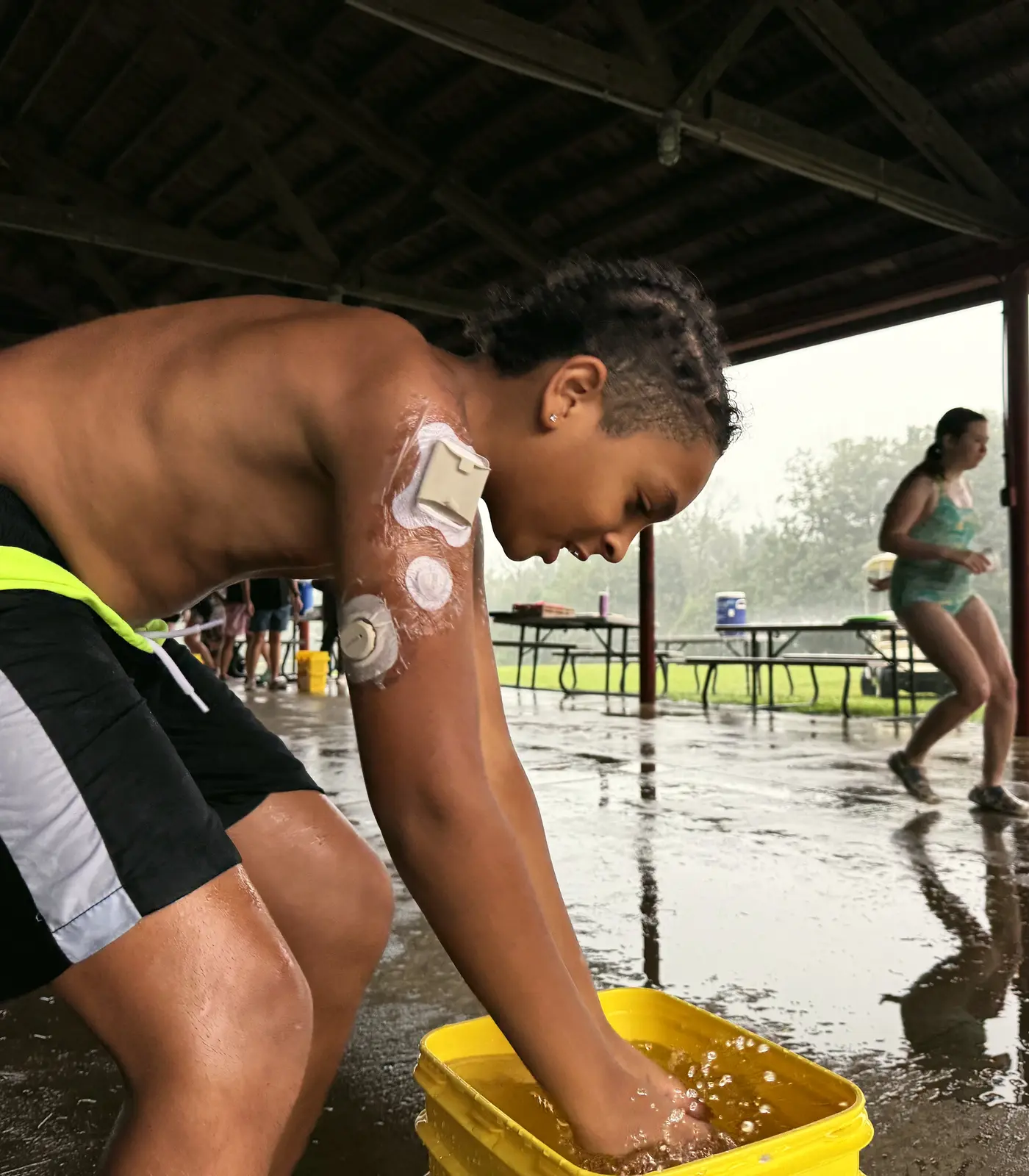 A camper with a CGM sensor on his arm washes his hands under the pavilion on a rainy day.