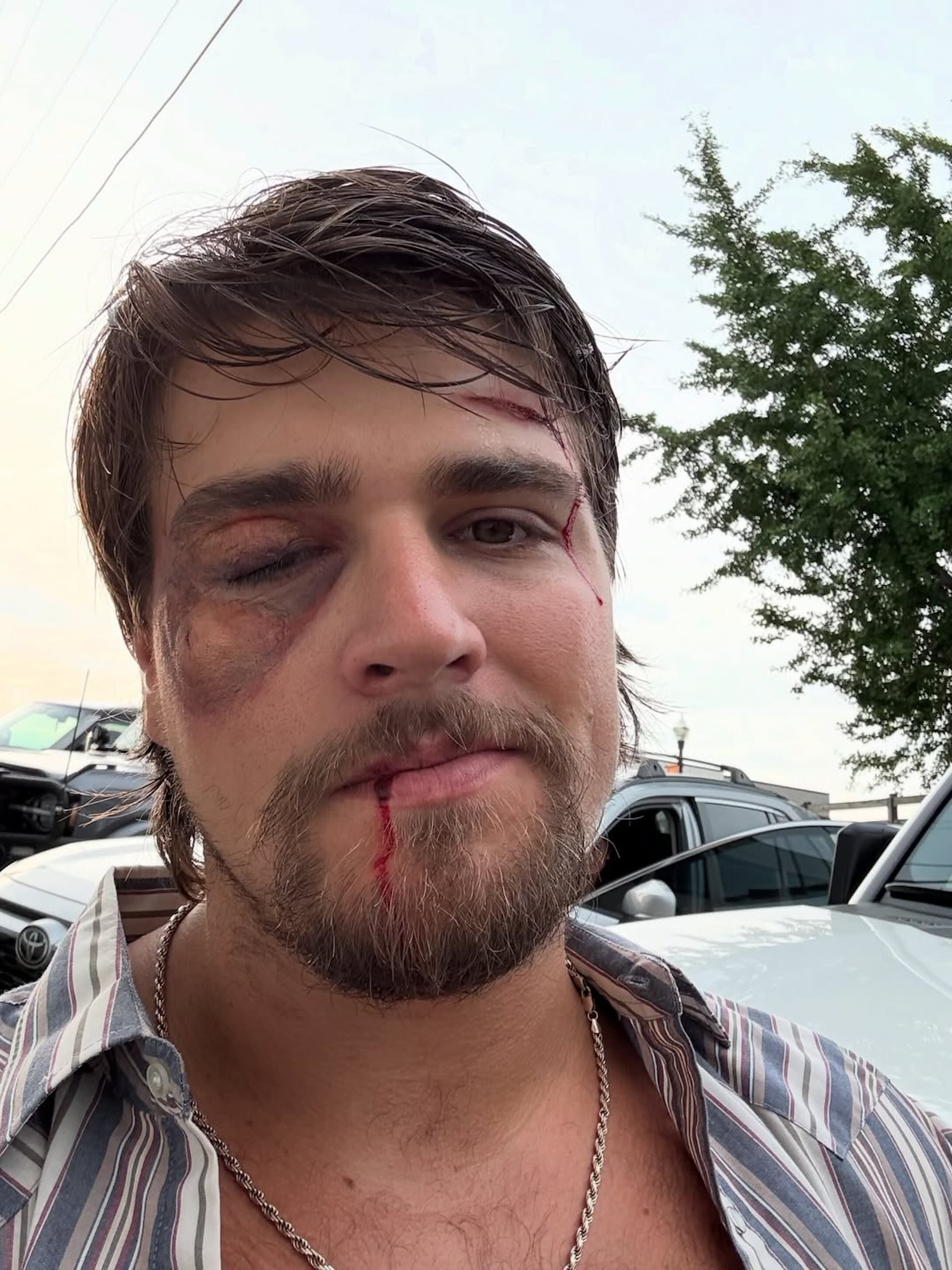 <p>Artist - Gavin Adcock Black Eye</p>