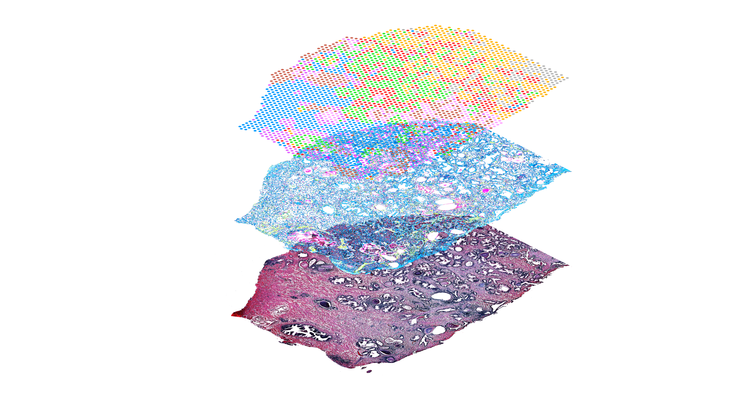 Brain Map - Part 4: The List is Good, But Is the Map Better? — Blog