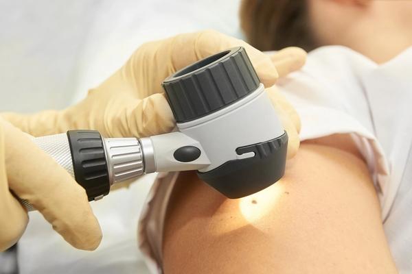 The Importance of Skin Checks & Early Detection
