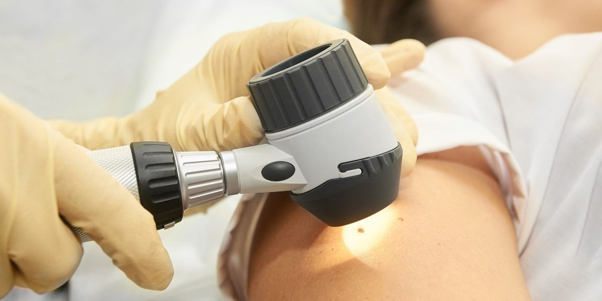 The Importance of Skin Checks & Early Detection