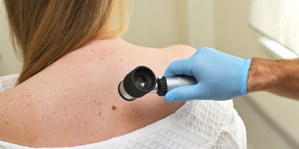 Government Support for Skin Cancer Prevention and Care on the NSW North Coast