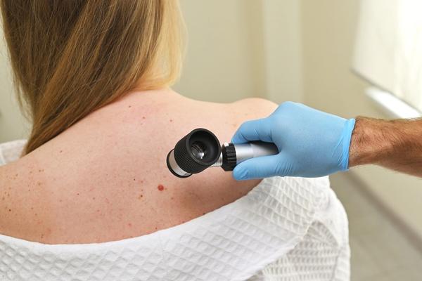 Government Support for Skin Cancer Prevention and Care on the NSW North Coast