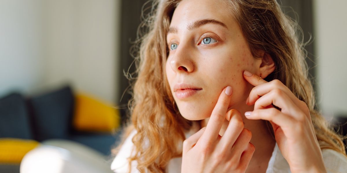 Skincare Mistakes