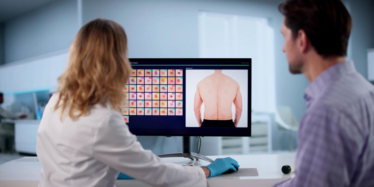 How AI is helping detect Skin Cancer
