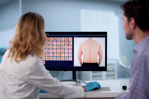 How AI is helping detect Skin Cancer