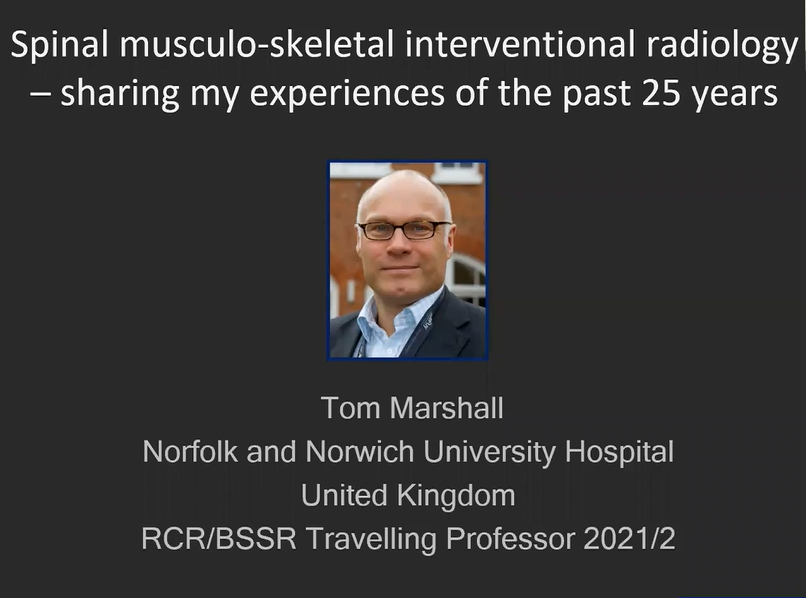 Dr Tom Marshall - Spinal musculo-skeletal interventional radiology webinar