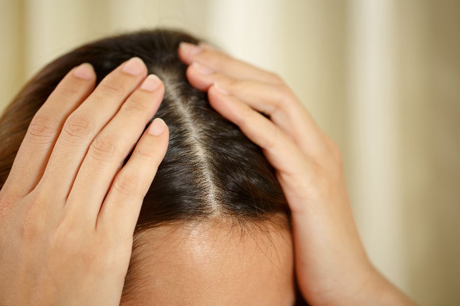 Female pattern hair loss  healthdirect