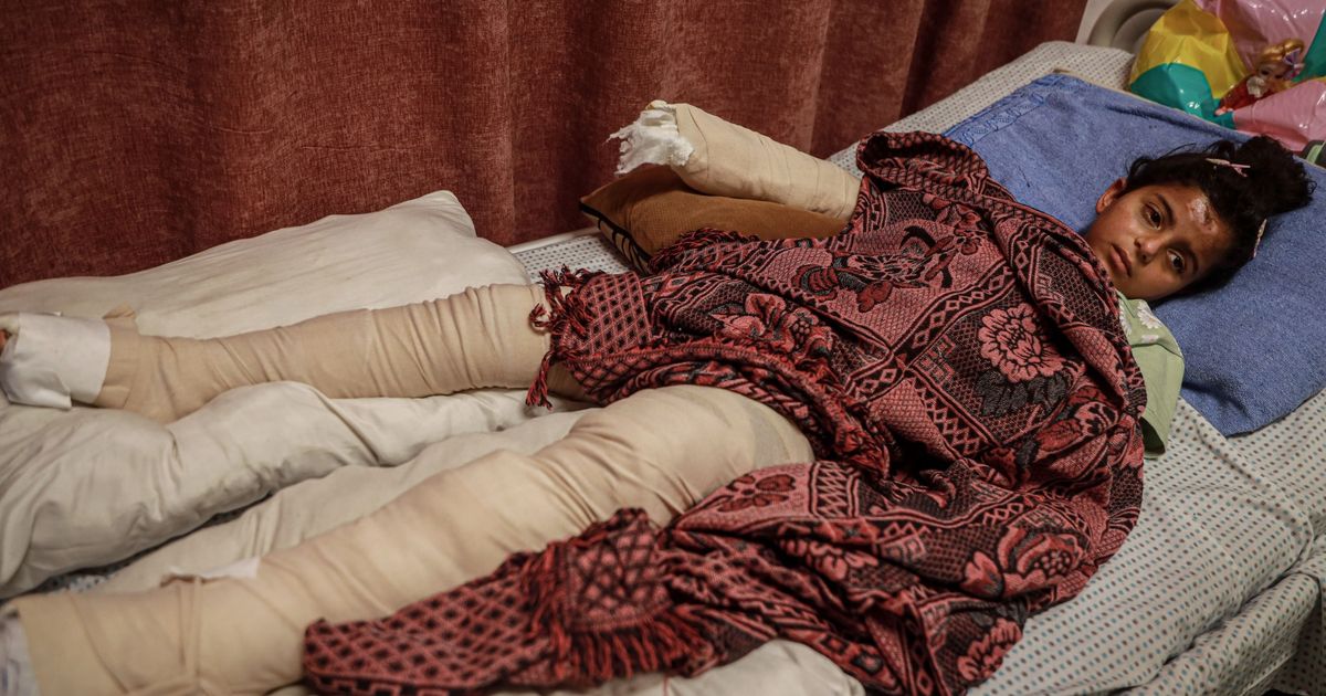 ‘Between pain and fear’: Gaza children bear cost of ongoing Israeli attacks