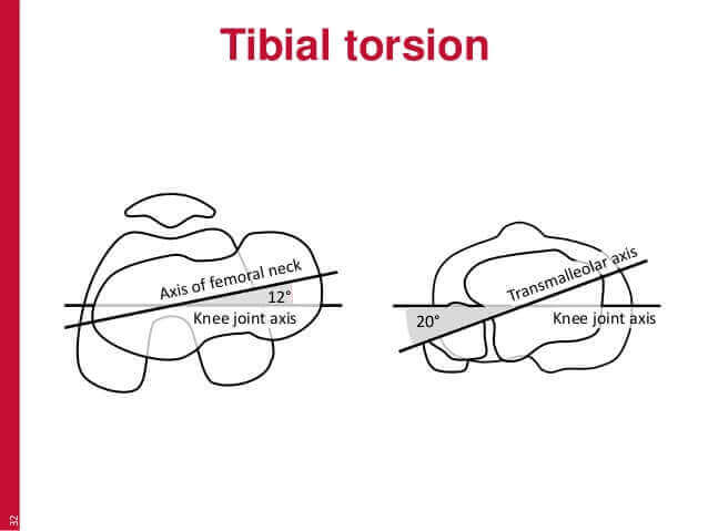 Ankle Joint Anatomy: Talocrural, Subtalar and Tibiofibular Joints