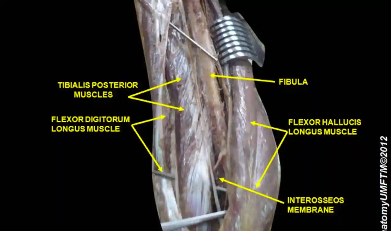 Vasa aberrantia connecting the brachial and radial arteries, image size:1280x755