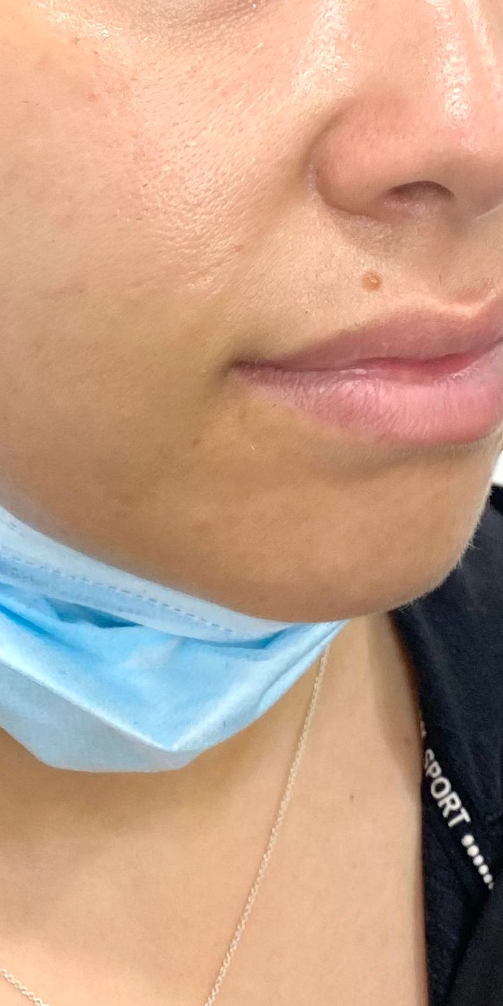 before image
