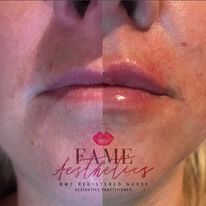 Clinic - Fame Aesthetics | Glowday