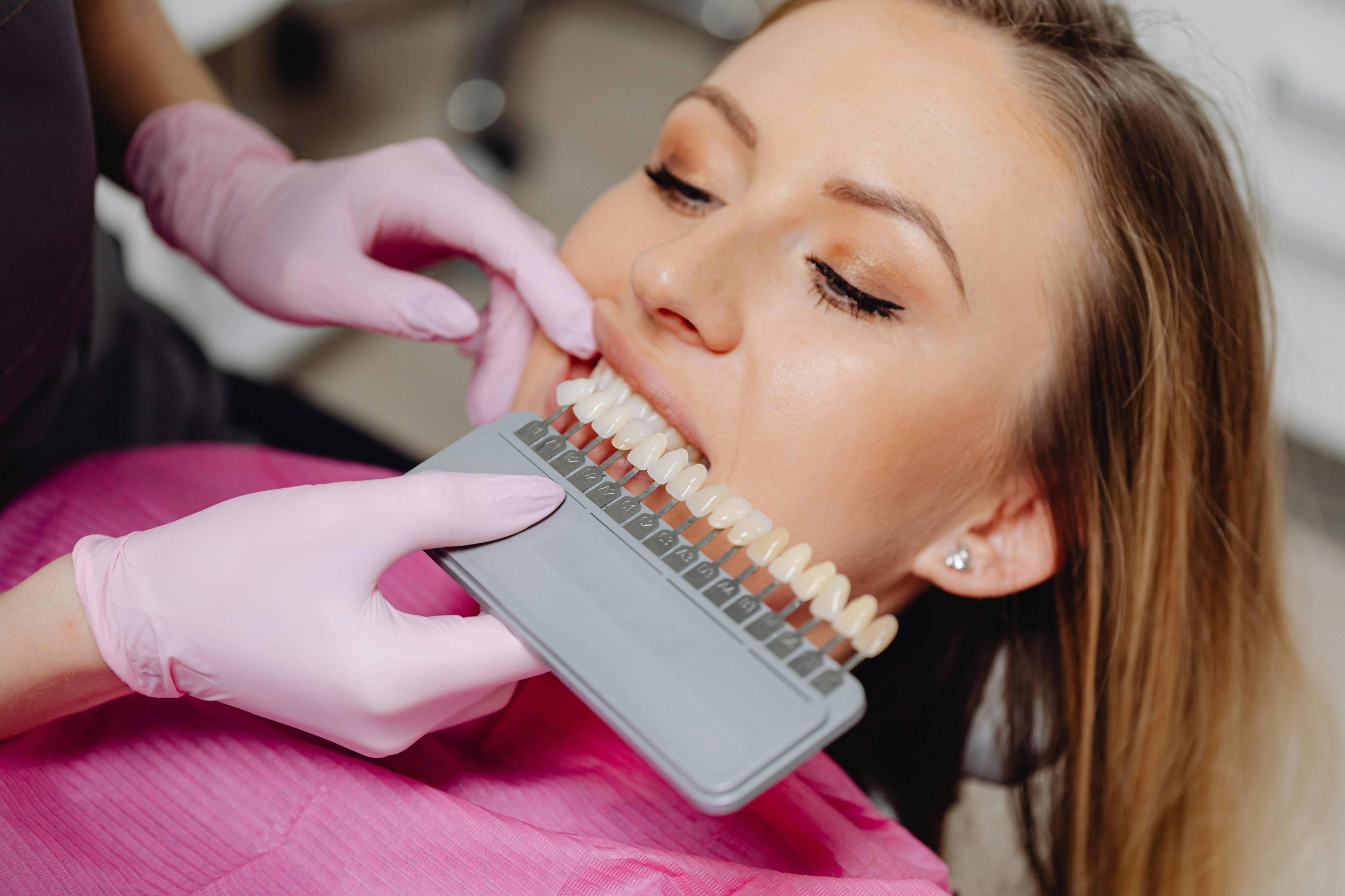 A stock photo of a female patient laying on a treatment table having her teeth colour-matched against a model