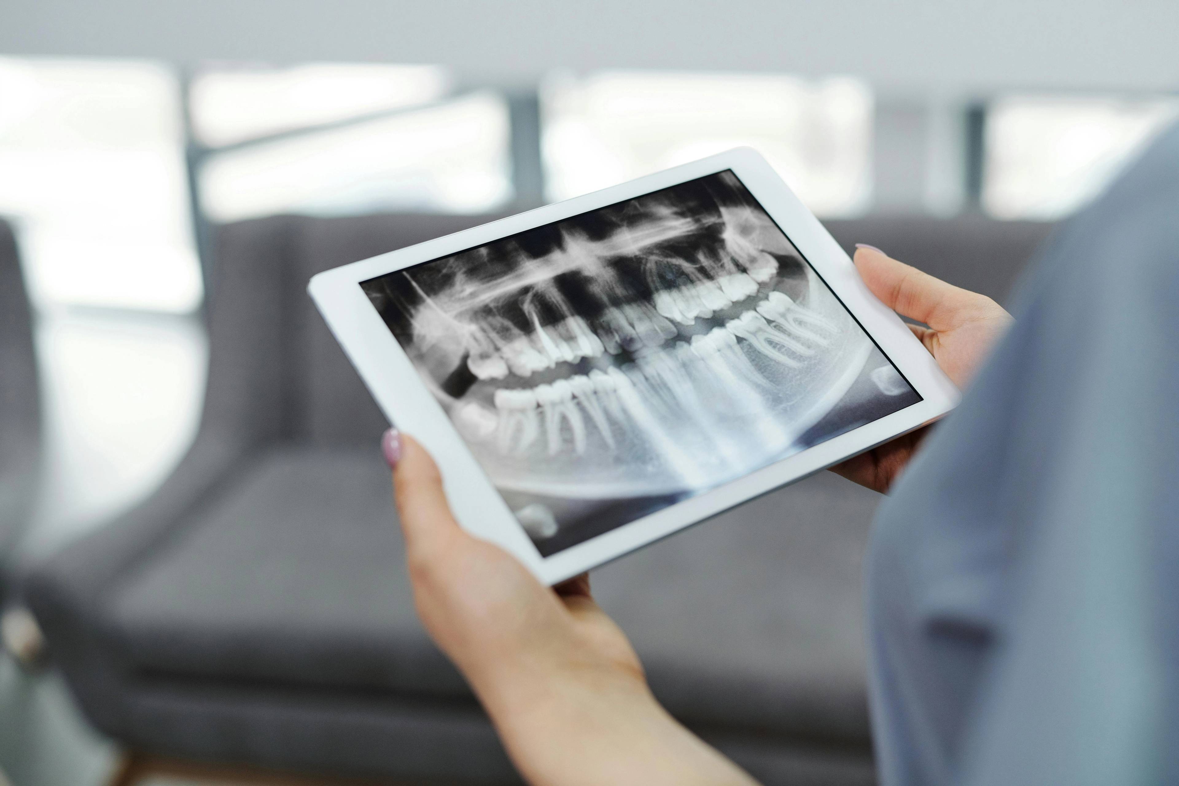 Digital panoramic dental X-ray displayed on a tablet during a patient consultation, supporting accurate diagnosis and personalised treatment planning at Pontesbury Dental.
