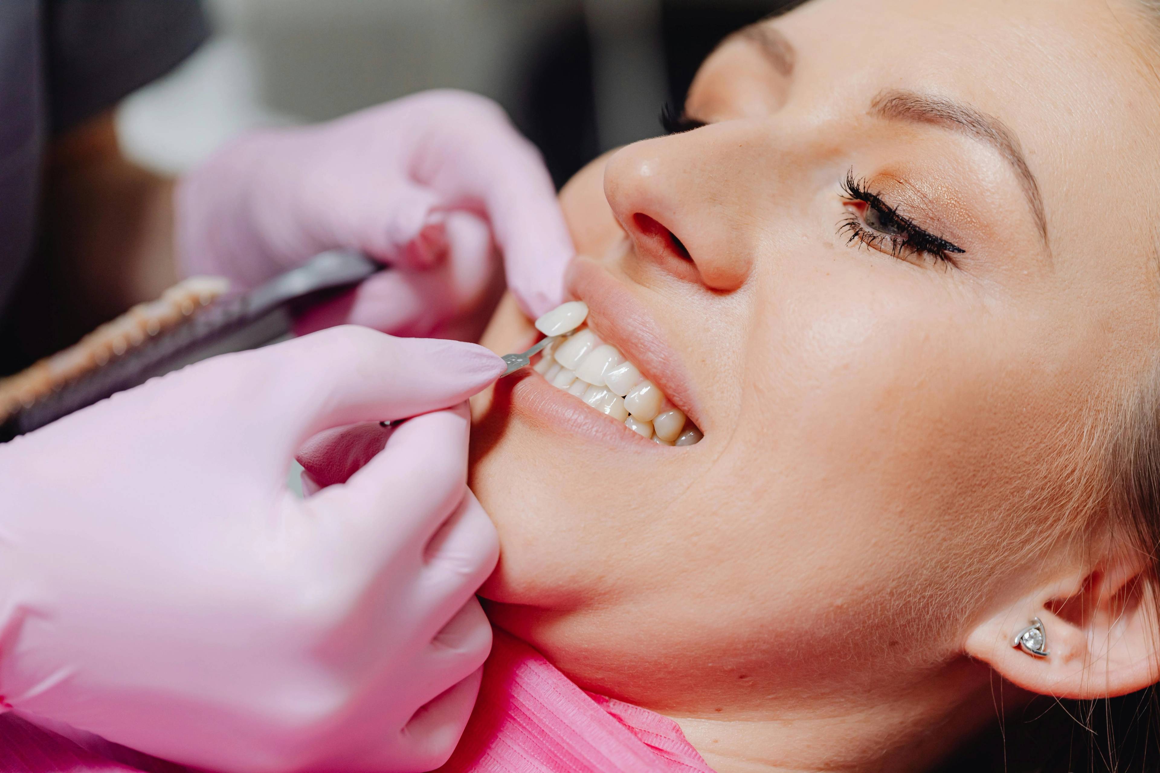 A stock photo of a female patient laying on a treatment table having a veneer attached to her tooth by a dentist wearing pink medical examination gloves