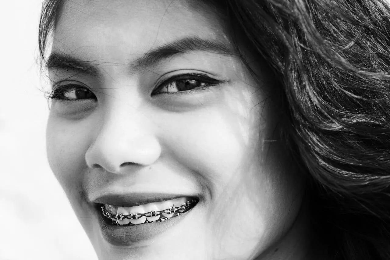 Alternative To Traditional Braces