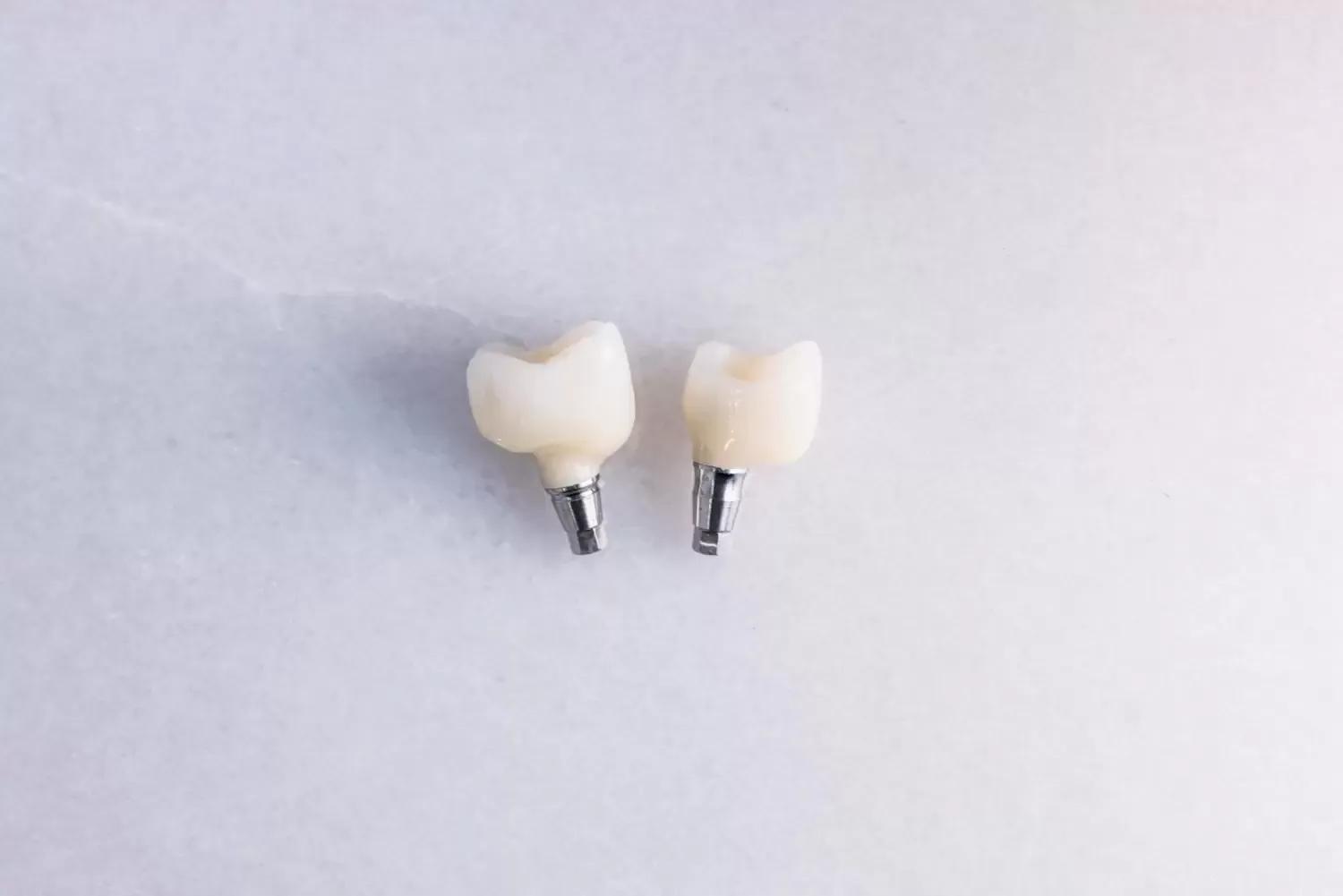 Multiple Dental Implants