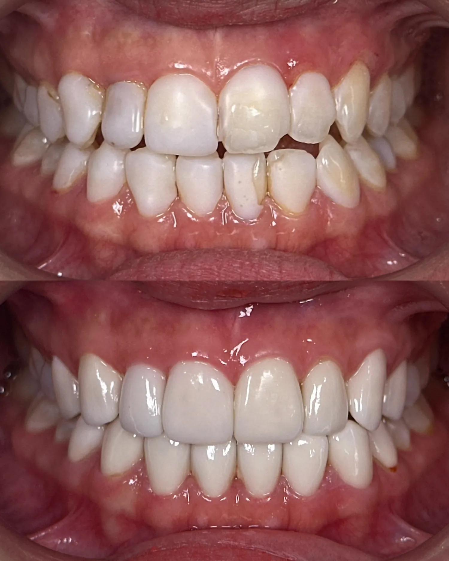 A Smile You're Proud of